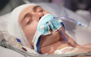 تهدید خاموش سرمایه انسانی؛ ضربه مغزی زندگی را متوقف می‌کند